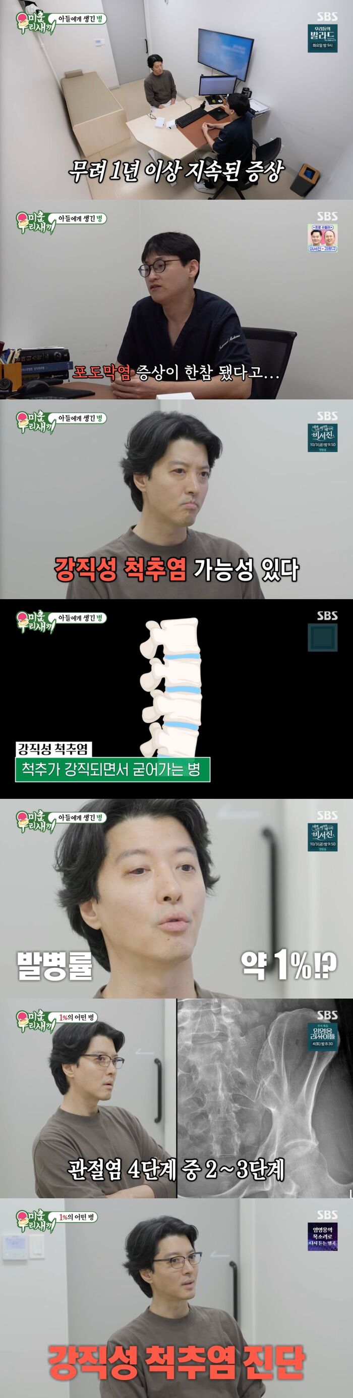 [스브스夜] '미우새' <b>이동건</b>, 우리나라 인구 1%에 발병하는 '<b>강직성</b> 척추...