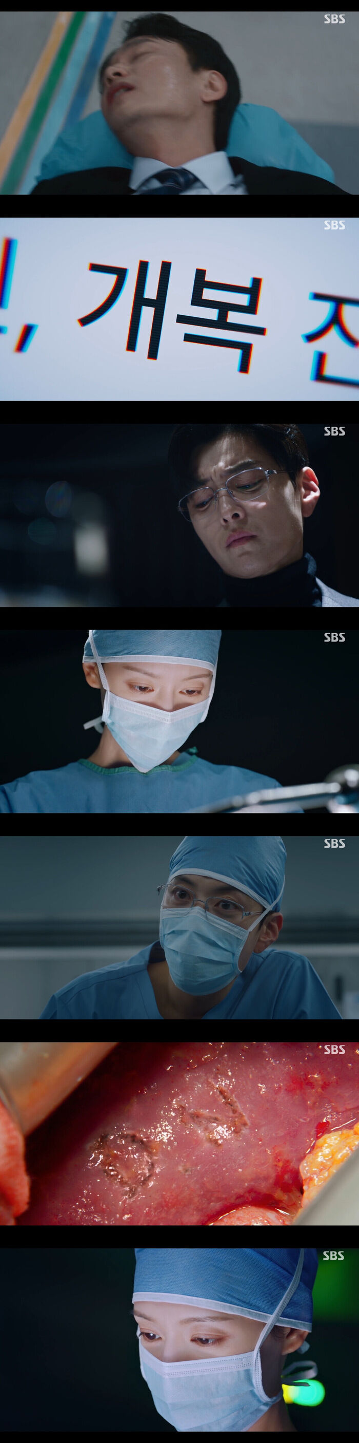 [스브스夜] '닥터X' 김지원, 개복 수술에서 <b>장승조</b>가 <b>환자</b>의 <b>장기</b>에 새...