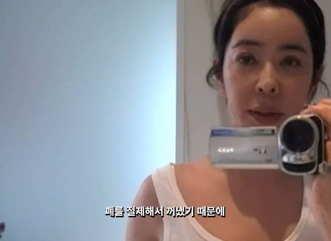 "달라진 얼굴·온몸 흉터 투성이"…<b>이혜영</b>, <b>폐암</b> 수술 후 근황 보니