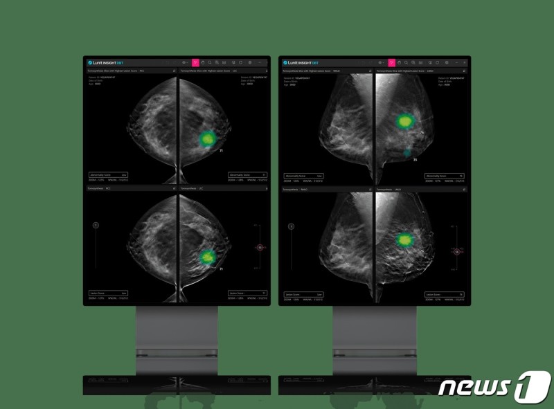 <b>루닛</b> 3D 유방암 검진 '<b>루닛</b> 인사이트 DBT', 미국 FDA 승인