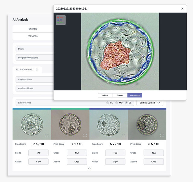 난임 시술 시 만들어지는 배아를 AI로 분석하는 소프트웨어 '비타 엠브리오' 활용 모습.(카이헬스 제공)/뉴스1