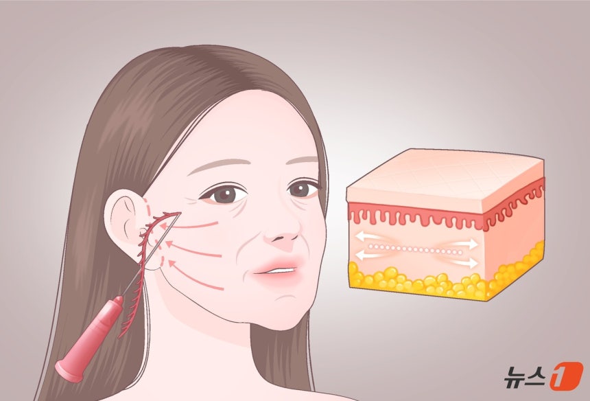 '복합 시술'은 에너지 기술로 구조를 정비하고 스킨부스터로 수분 환경을 채우는 원리라고 할 수 있다.에너지 디바이스 기반 시술과 히알루론산 제제는 서로 다른 층위에서 피부 상태를 보완함으로써 보다 자연스럽고 조화로