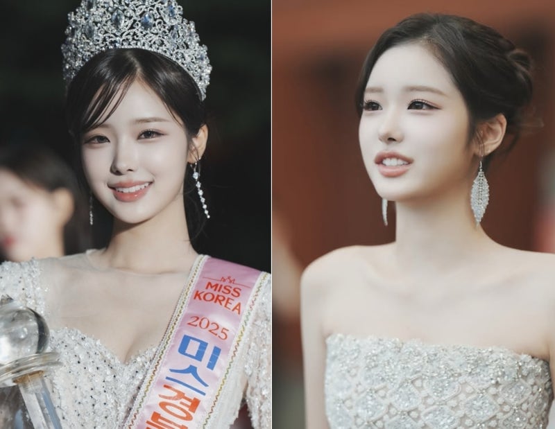 자연미인이면 가치 올라가나? 미스코리아 성형 논란에 팩폭 날린 전년도 진