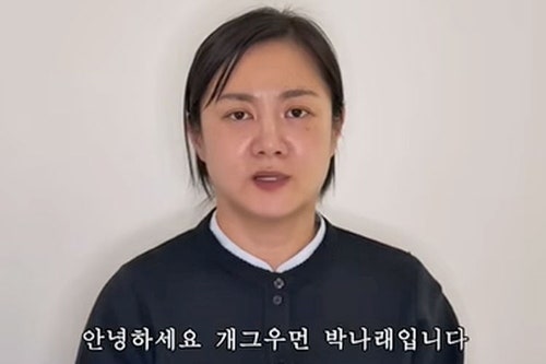 "박나래 술잔에 맞아 4바늘 꿰매"…박나래 "그런 적 없다"