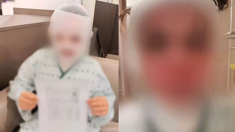 다른 남자 못 만나게 아내 얼굴에 끓는 물 부은 남편 구속영장 신청