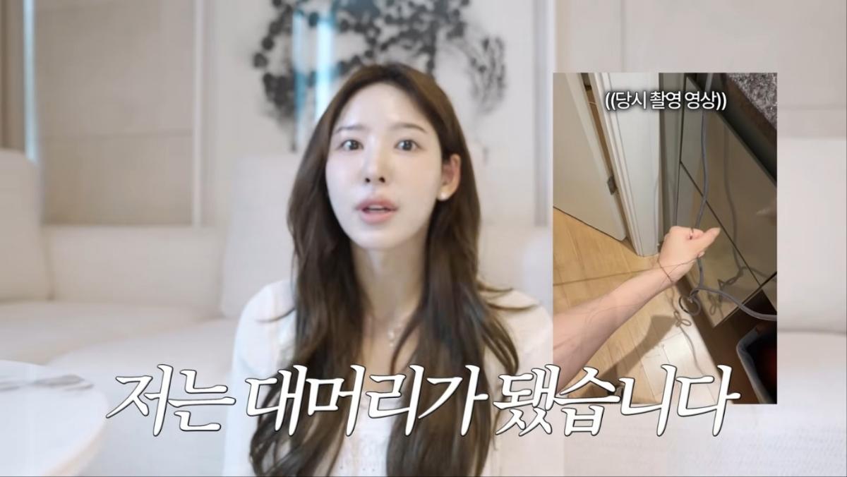 "<b>머리</b> 1~2cm 채우려다 30cm 빠졌다"…<b>이나연</b>, 모발이식 부작용 고백 [MHN...