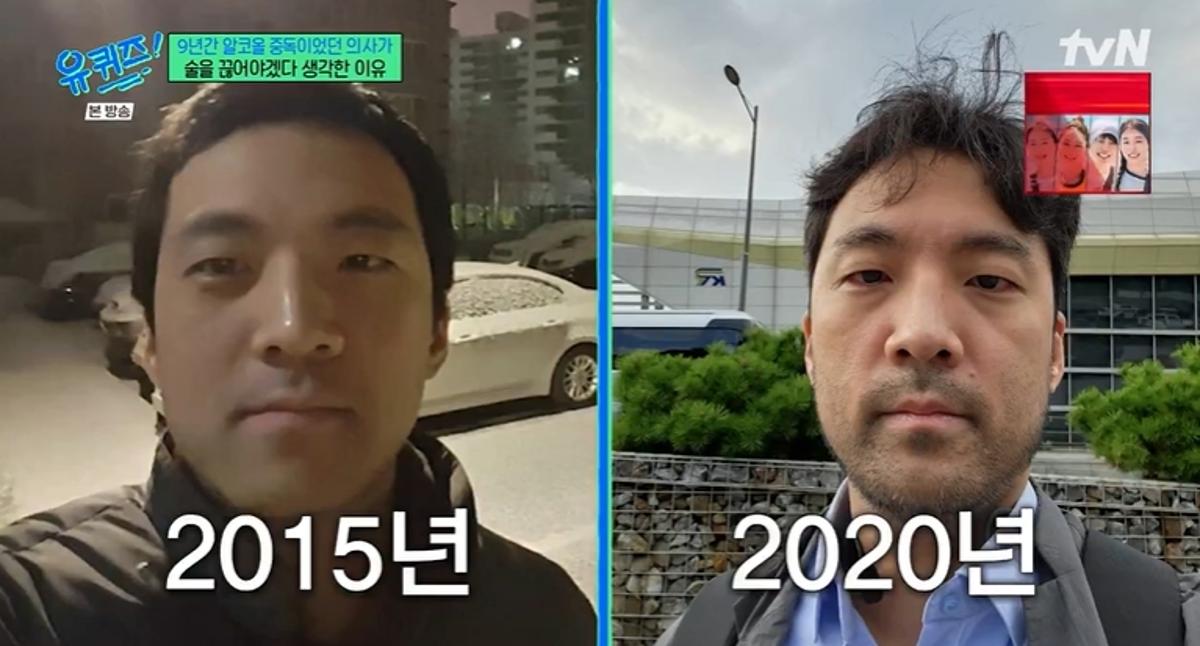 '알코올 중독'과 9년 싸운 <b>의사</b>의 충격적 외모 변화…유재석 "담배 끊을...