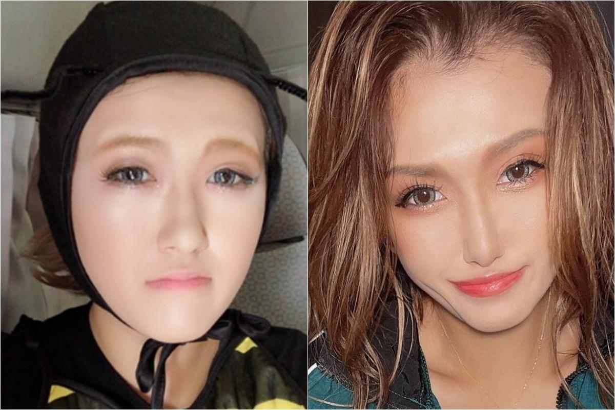 日本のタレント・タダが公開した手術前後の顔写真