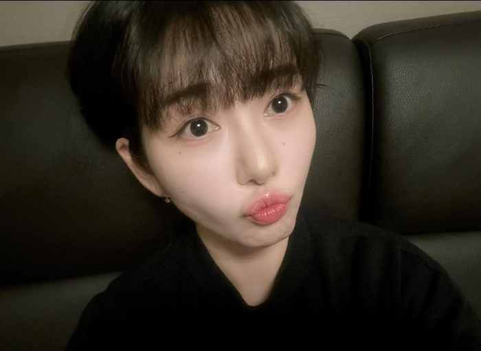 <b>피부과</b> 상담실장까지 했던 <b>권민아</b>, 이번엔 고객으로 폭발…“환불 요청...
