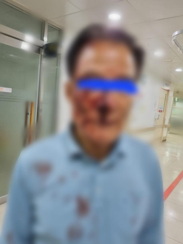 지난달 31일 경북 포항시 북구에서 50대 승객에게 폭행당한 60대 택시기사의 모습. 온라인 커뮤니티 캡처.