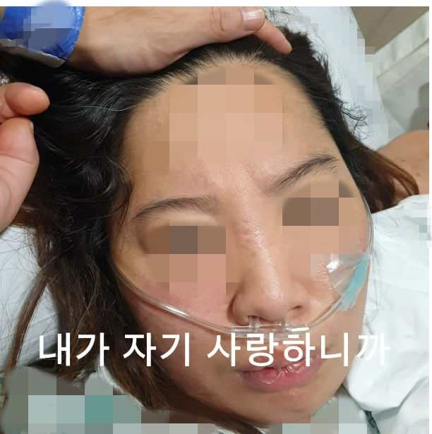 김모(44)씨의 아내는 2021년 출산 중 사고로 중증 치매를 앓게 됐다. 집 밖을 나가 배회하는 치매 증상이 심해지면서 남편은 직장도 그만둔 채 아내를 간호하고 있다. 사진은 출산 직후 3주간 혼수상태에 있다가 깨