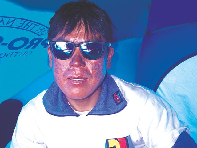 1997년 가셔브룸 등반 때 얼굴에 화상을 입은 엄홍길. 엄홍길휴먼재단 제공