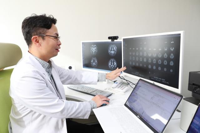 응급 환자 뇌혈관 이상 원인 제대로 파악한 AI… 왓슨 이후 ‘2막’ 기대