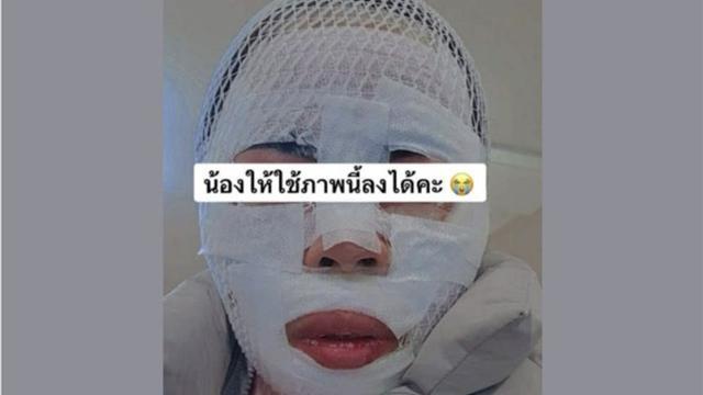 화상 입은 태국인 아내.연합뉴스