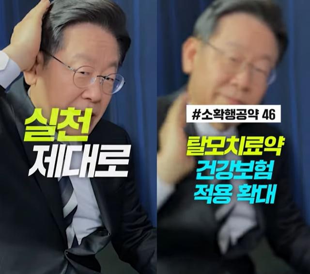 '탈모 건보 적용 검토' 李 언급에 갑론을박… "환영" vs "그게 질병?"