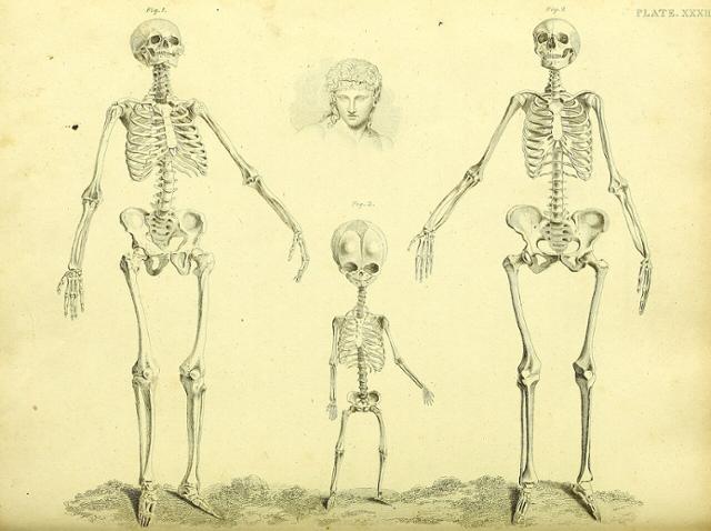 19세기 스코틀랜드 해부학자인 존 바클레이의 주장을 토대로 그려졌다고 알려진 해골 그림.맨 오른쪽의 여성 해골은 실제보다 두개골은 더 작게,<a href=