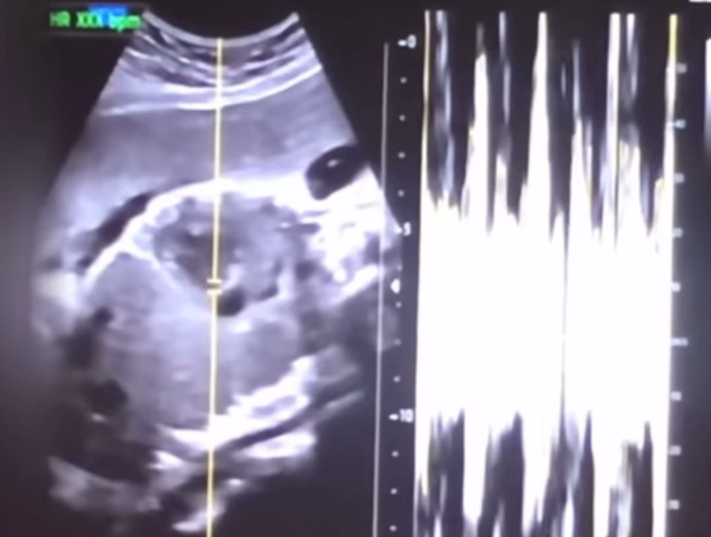 '36주 임신중지' 산모 징역 6년 구형... "수술로 태아 사망, 알았을 것"