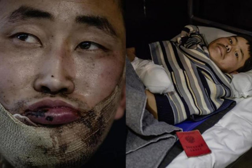 우크라이나군이 생포한 북한군 저격수 정찰장교(왼쪽·26)와 소총수(오른쪽·20)가 키이우 모처에서 치료받고 있다. 지난해 1월 볼로디미르 젤렌스키 우크라이나 대통령이 공개한 사진이다. 젤렌스키 대통령 엑스(X) 화면