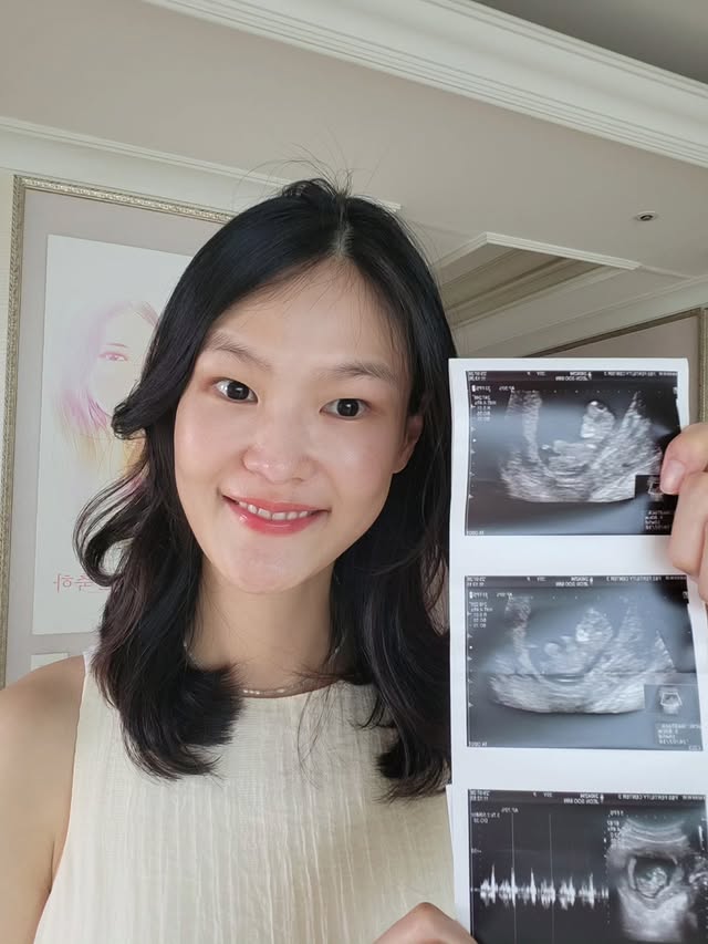 <b>김경진</b><b>전수민</b>, 난임 극복하고 <b>쌍둥이</b> 임신 "함께 축복해주세요"