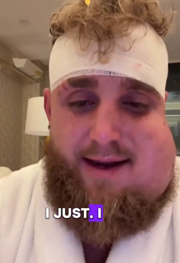 '맷값 1364억원' 근황 충격! 제이크 폴, '얼굴 퉁퉁' 진짜 죽다 살아났다 → "다시는 링에 못 설 것" 예언