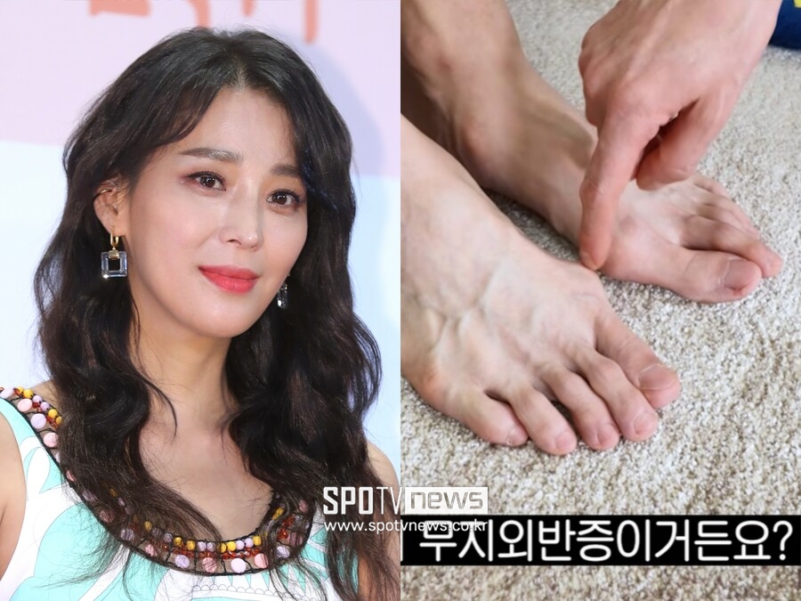 "저런 인간 발은 처음"…<b>한고은</b>, '7년 무직' <b>남편</b> "무지외반증 말기" 호...