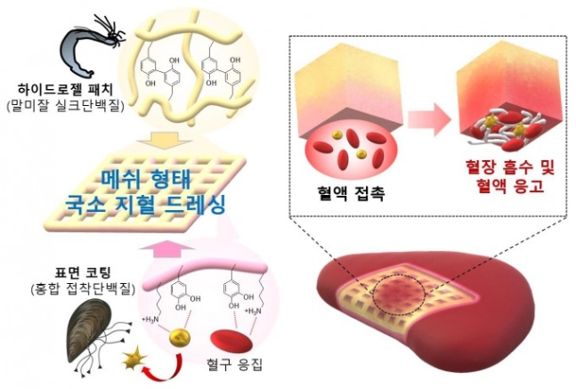 말미잘과 홍합 단백질을 활용한 건조 하이드로젤 메쉬 형태의 흡수성 국소 지혈 드레싱 원리. 포스텍 제공