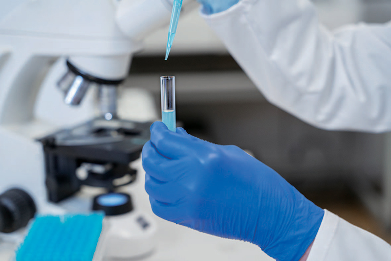 췌장암은 몸 깊은 곳에 있고 주변 혈관·장기와 가까워 조직 채취가 어렵다.이를 보완하기 위해 액체 생검(liquid biopsy)이 주목받고 있다.혈액·소변 등 체액에서 암의 흔적을 찾아 분석하는 방식이다.ⓒf