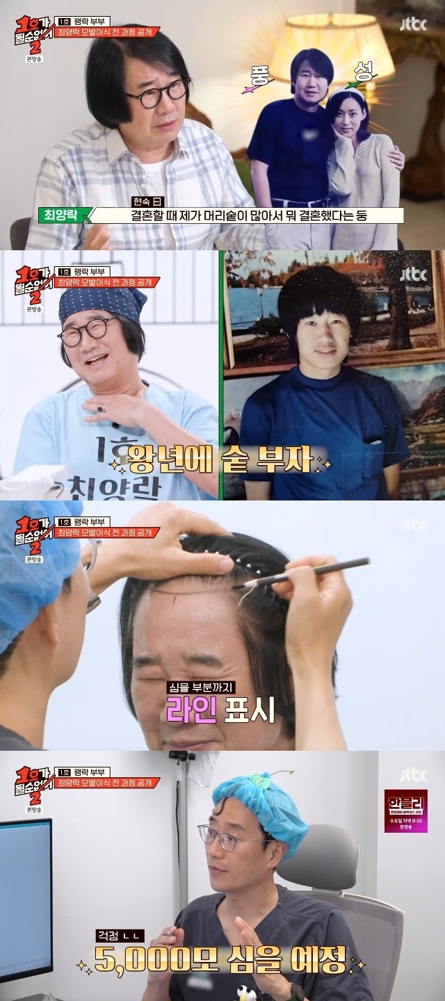 <b>최양락</b>, 숱부자 과거→탈모로 빈 앞머리 공개‥5천모 <b>모발이식</b> 결정(1호...