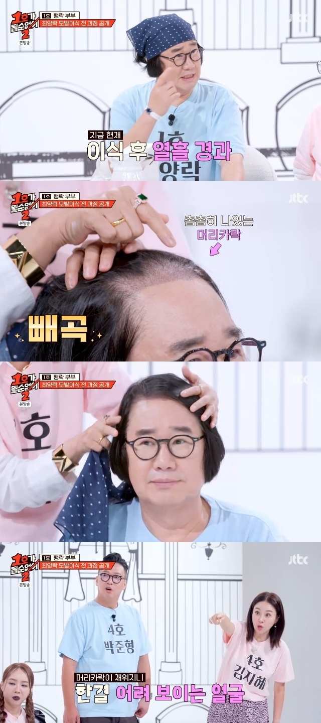 <b>최양락</b> 5014모 <b>모발이식</b>, 열흘만 빼곡해진 이마+어려진 얼굴(1호가)