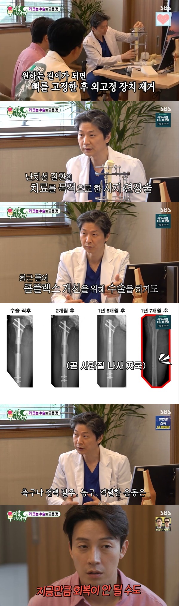 “최소 4천만 원” 168 <b>허경환</b> 김준호, <b>사지 연장술</b> 상담 ‘진지’ (미...