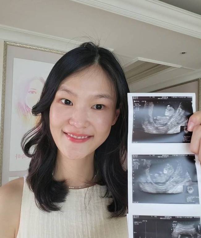 난임 고백했던 <b>김경진</b><b>전수민</b>, <b>쌍둥이 임신</b> 공개