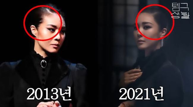 <b>옥주현</b> ‘탈모’ 뮤지컬 배우 고충→<b>모발 이식 부작용</b> “이게 무슨 일인...