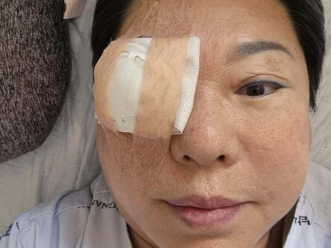 난소암 말기 이겨낸 <b>양희은</b>, 각막이식 <b>수술</b> 후 회복 중 “난 아파야만 ...