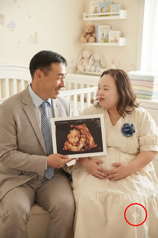 다운증후군 <b>서은혜</b>조영남 <b>임신</b>? <b>AI</b>로 만든 초음파 <b>사진</b> 공개에 “축하...