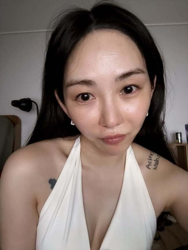 ‘얼굴 2도 화상’ <b>권민아</b>, <b>피부과</b>와 갈등에 녹취까지 공개 “내용증명...
