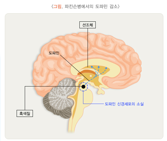 파킨슨병 도파민 감소 도식도. 질병관리청
