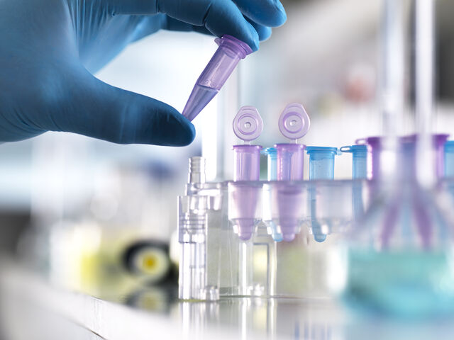 고지혈증 치료제 피타바스타틴이 기존 항암제에 내성을 보이는 삼중음성유방암 세포와 암줄기세포의 생존을 직접 억제해 재발·전이 가능성을 낮출 수 있다는 연구 결과가 발표됐다.사진은 기사의 특정 사실과 관련 없음.클립