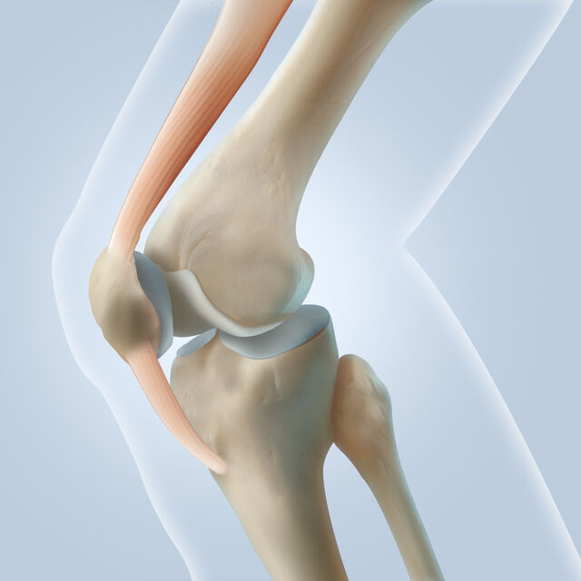 슬개골 연골연화증은 슬개골과 대퇴골 사이 연골이 약해지거나 손상되며 통증이 발생하는 질환이다.클립아트코리아