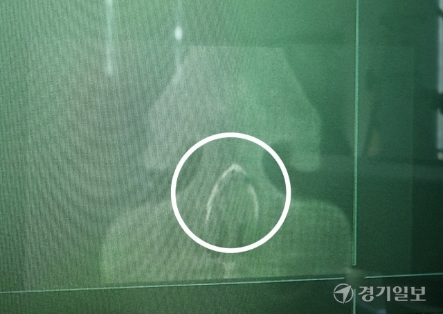 지난 10월21일 평택 B초등학교에서 학교폭력이 발생했다.사진은 동급생 다툼을 말리다 코뼈가 골절된 피해 학생의 X-ray 사진.제보자 A씨 제공