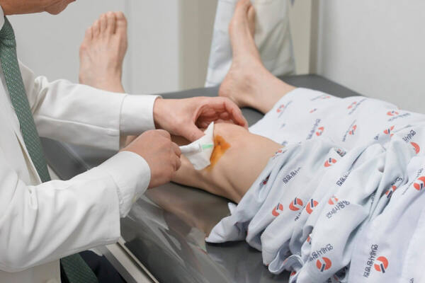 고용곤 연세사랑병원 병원장이 무릎 퇴행성관절염 환자에게 자가지방유래 기질혈관분획(SVF) 주사 치료를 시행하고 있다.연세사랑병원