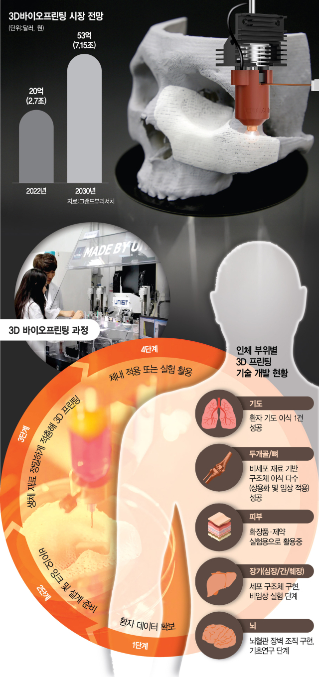 뉴스 썸네일
