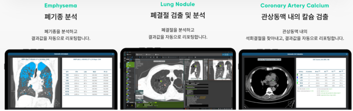 뉴스 썸네일