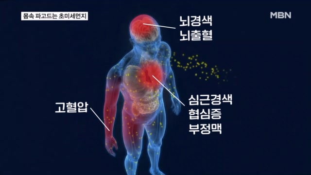 뉴스 썸네일