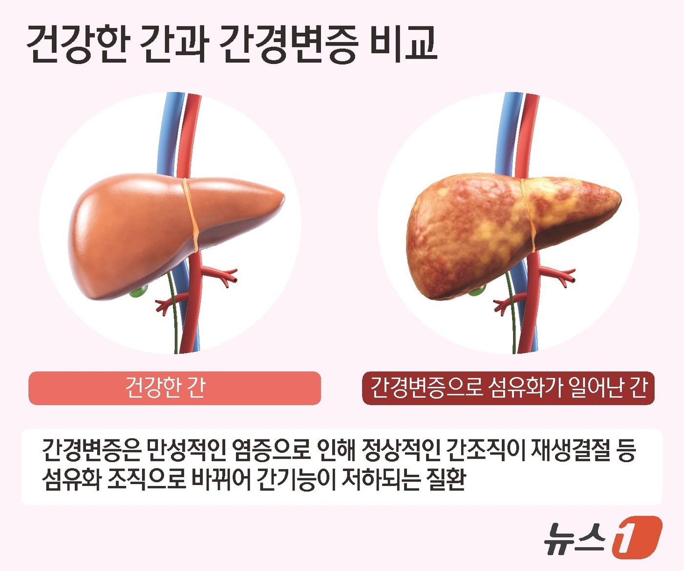 뉴스 썸네일