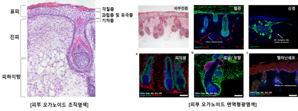 뉴스 썸네일