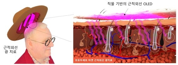 뉴스 썸네일