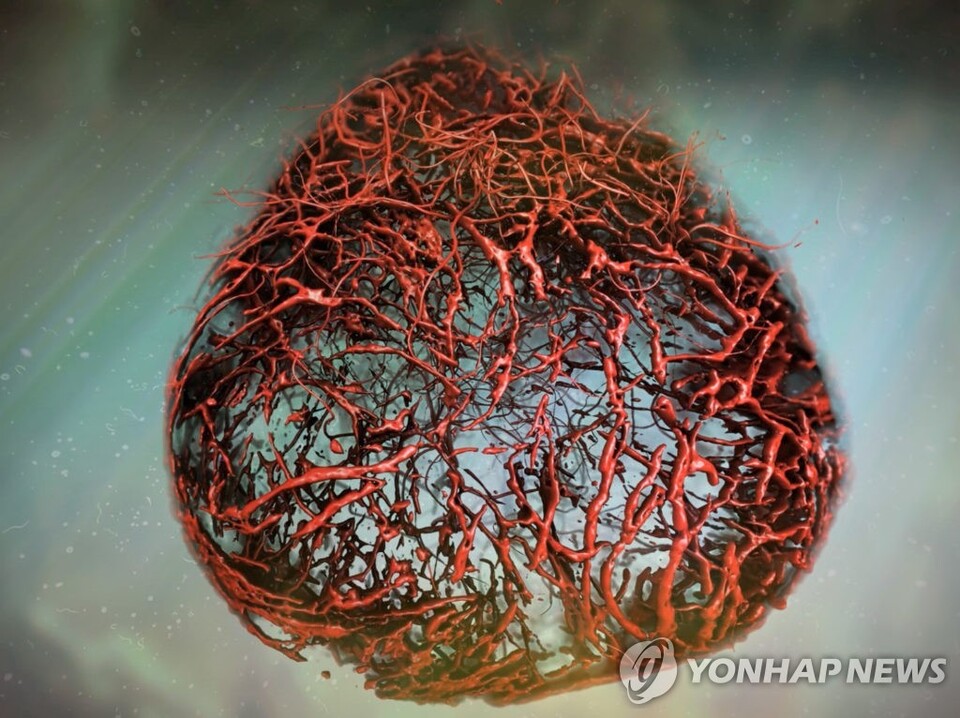 뉴스 썸네일