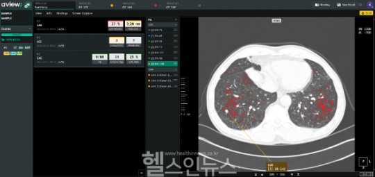 뉴스 썸네일